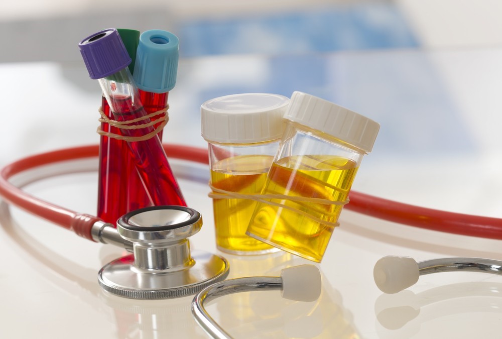 Synthetic Urine Whizzinator Silver Springs Lafayette CA
